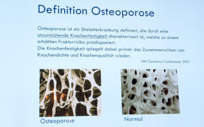 2026 | 14.4. | Osteoporose